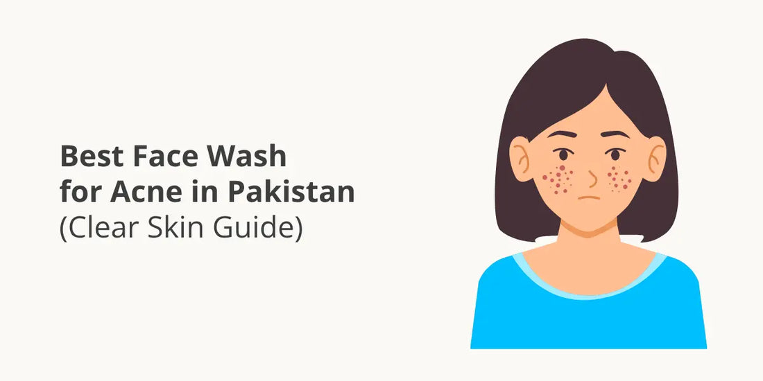 Best Face Wash for Acne in Pakistan (Clear Skin Guide)