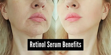 Retinol Serum Benefits: Unveiling the Fountain of Youth for Your Skin