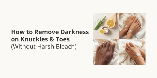 How to Remove Darkness on Knuckles & Toes (Without Harsh Bleach)