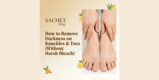 How to Remove Darkness on Knuckles & Toes (Without Harsh Bleach)
