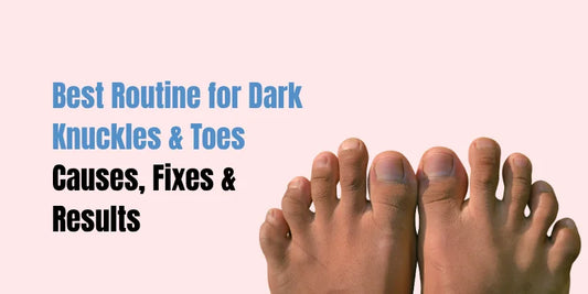 Best Routine for Dark Knuckles & Toes — Causes, Fixes & Results