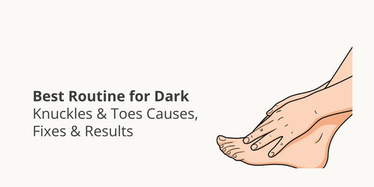 Best Routine for Dark Knuckles & Toes — Causes, Fixes & Results