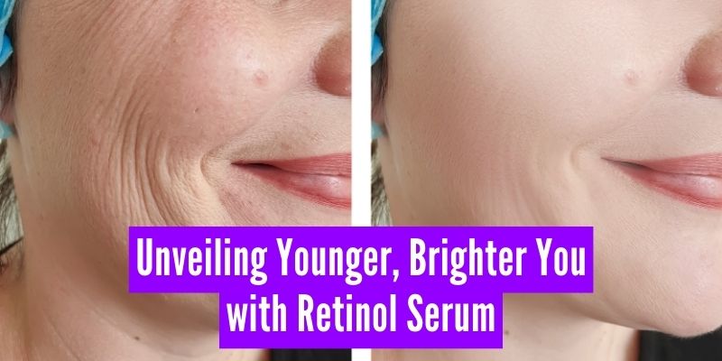 Unveiling Younger, Brighter You: SACHET Retinol Skin Renewing Night Serum - Pakistan's Secret to Radiant Skin