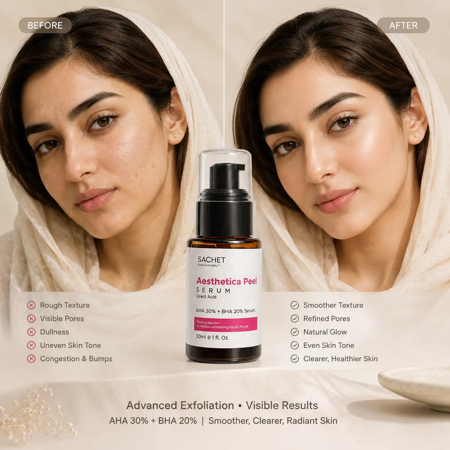 Aesthetica Peel Serum in Pakistan – AHA 30% BHA 20% Deep Exfoliation