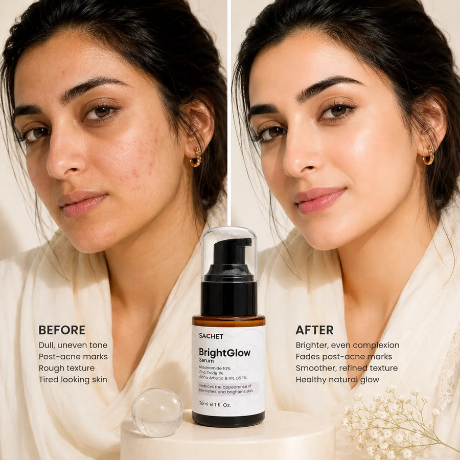 BrightGlow Serum in Pakistan – Niacinamide + Zinc for Even Skin Tone