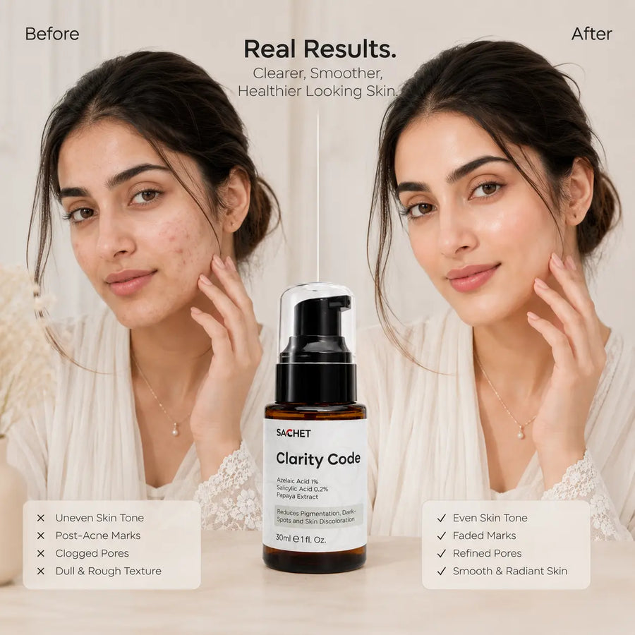 Clarity Code Serum in Pakistan – Azelaic Serum for Dark Spots