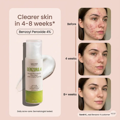 BENZORA 4 – Benzoyl Peroxide 4% Anti-Acne Face Wash