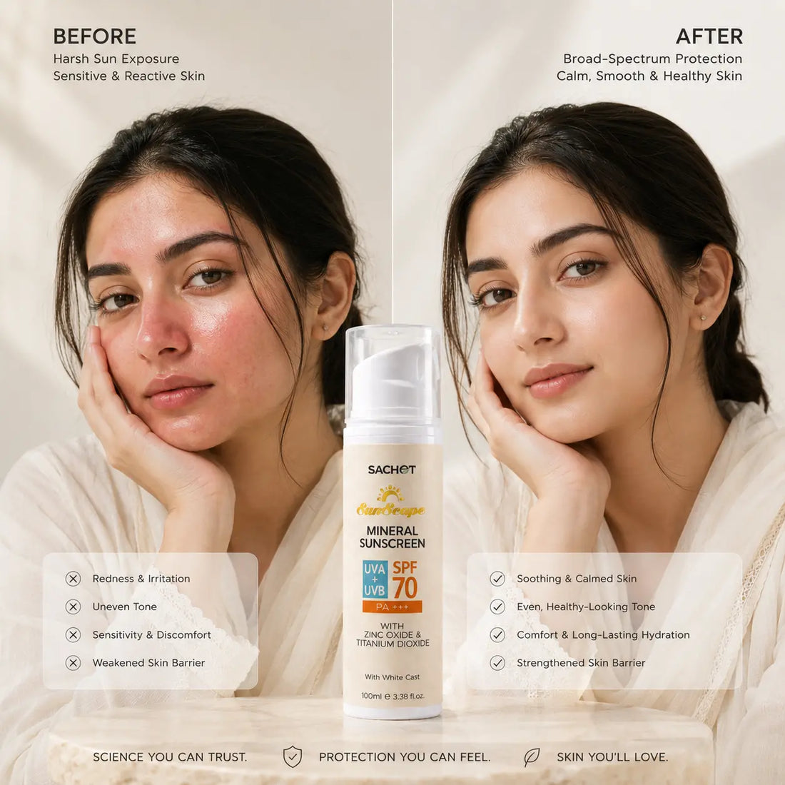 https://sachetcare.com/cdn/shop/files/mineral-sunscreen-spf-70-white-cast-100ml-288.webp?v=1768131492&width=1100