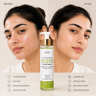 Salicylic Acid Face Wash in Pakistan | Acne & Oil Control Cleanser